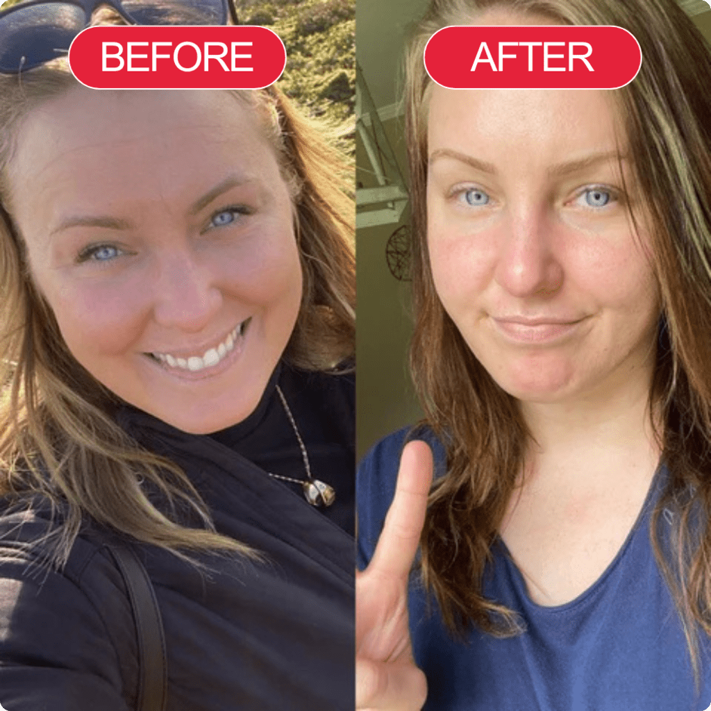 Madeca Cure Time Reverse Cream (All-In-One)