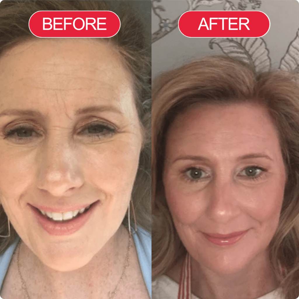 Madeca Cure Time Reverse Cream (All-In-One)