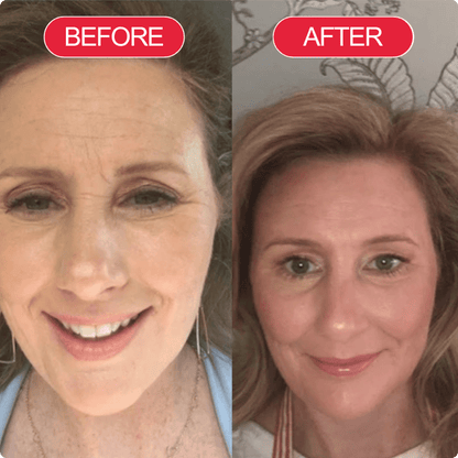 Madeca Cure Time Reverse Cream (All-In-One)