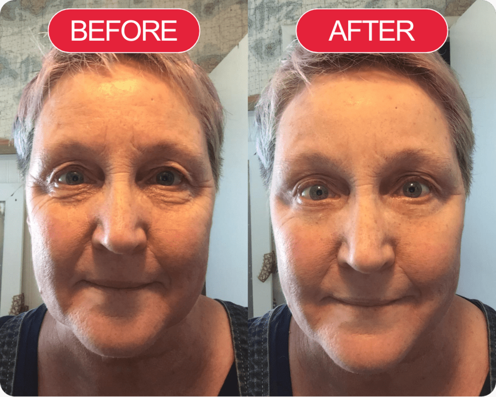 Madeca Cure Time Reverse Cream (All-In-One)