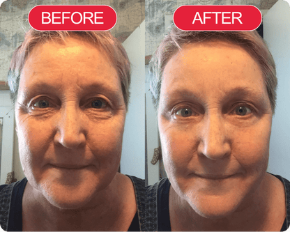 Madeca Cure Time Reverse Cream (All-In-One)